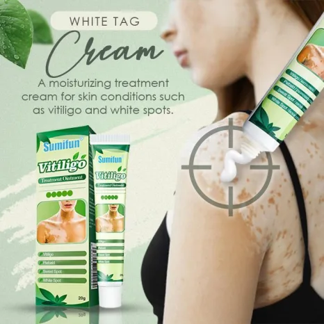 Sumifun Vitiligo Cream
